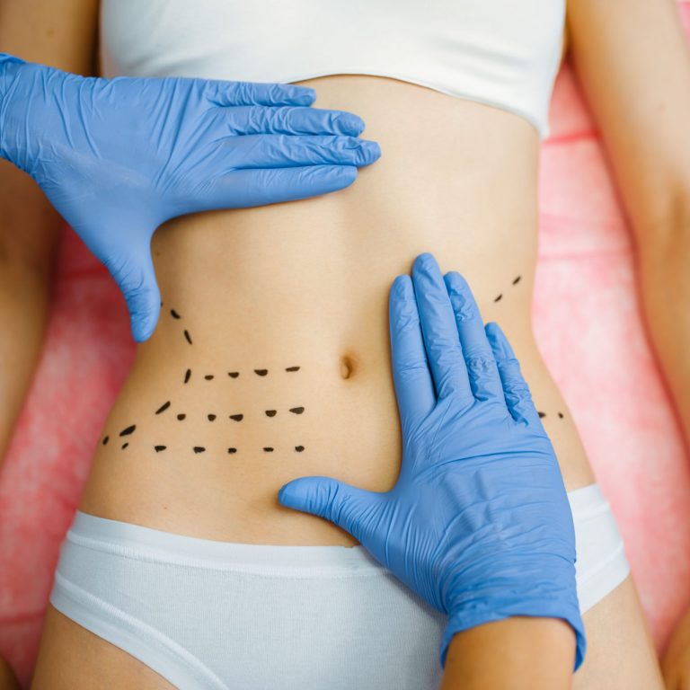 Cosmetician's hands on female patient abdomen, botox therapy preparation. Rejuvenation procedure in beautician salon. Cosmetic surgery against wrinkles and aging