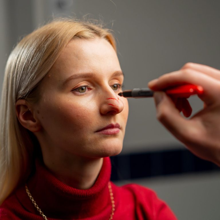 in a plastic surgery clinic doctor makes markings on the face of a young girl before surgery